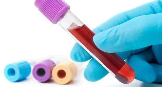 Blood Culture Test Market 2019- 2028 Upcoming Trends, Analysis,&nbsp;Forecast