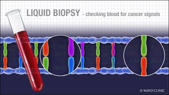 Liquid Biopsy Market Investigation Reveals Enhanced Growth during the forecast Period,&nbsp;2019-2023