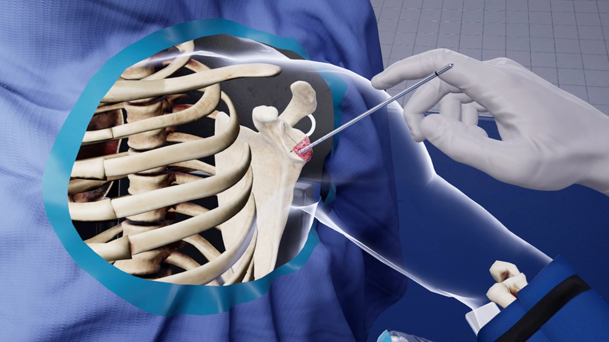 Orthopedic Software Market Size Will Achieve Skyrocketing USD 446.8 million by&nbsp;2026